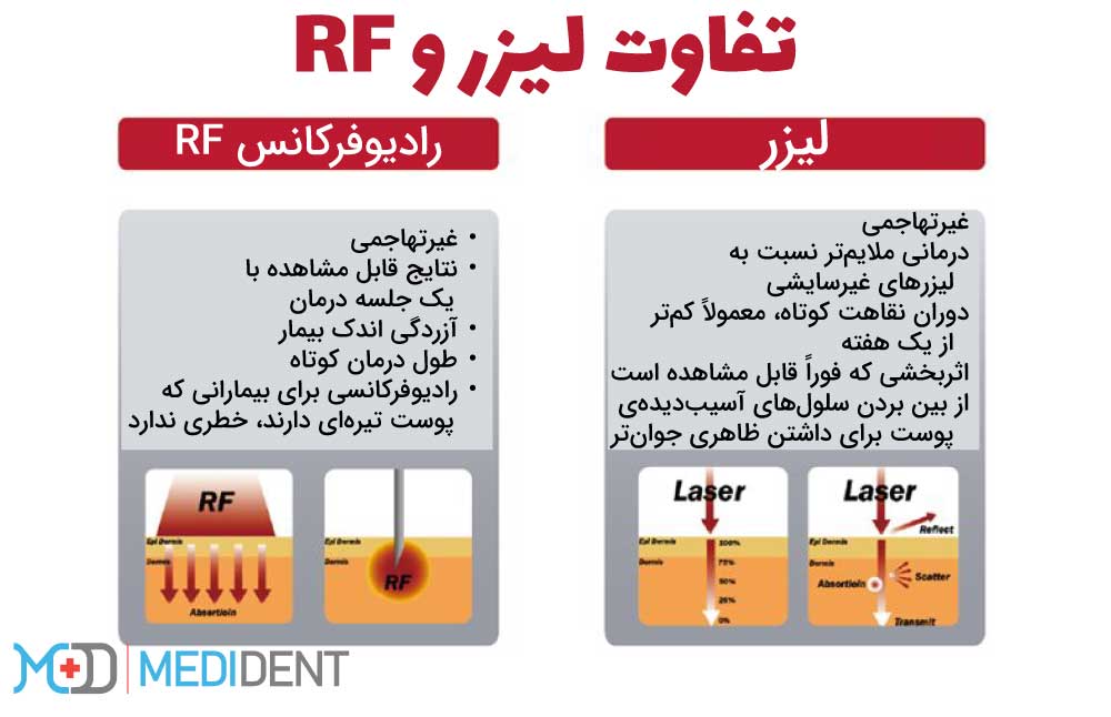 تفاوت لیزر و RF